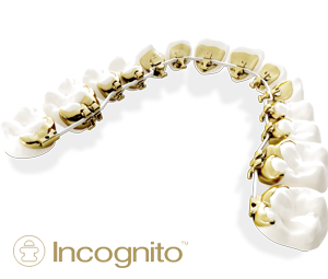 Incognito-System
